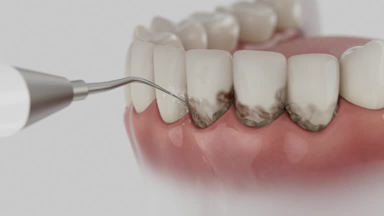 Trusted Emergency Dentist service in Mesquite, TX - Dentist Open Now